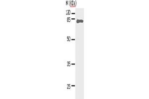 Western Blotting (WB) image for anti-Signal Transducer and Activator of Transcription 5A (STAT5A) antibody (ABIN2427590) (STAT5A antibody)