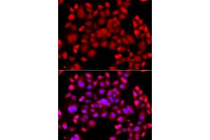 Immunofluorescence analysis of A549 cells using PIP4K2B antibody. (PIP4K2B antibody)