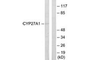 Western blot analysis of extracts from HeLa cells, using Cytochrome P450 27A1 Antibody. (CYP27A1 antibody  (AA 101-150))