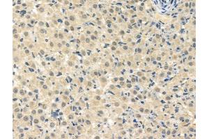 ABIN7093263 and ABIN7097282 at 1/100 staining Rat ovarian tissue by IHC-P. (HSF1 antibody  (pThr142))