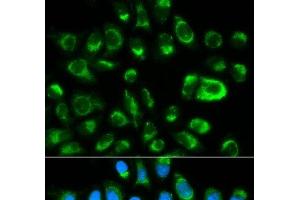Immunofluorescence analysis of HeLa cells using GAS2 Polyclonal Antibody