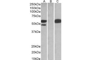 HEK293 lysate (10ug protein in RIPA buffer) overexpressing Human TRIM21 with C-terminal MYC tag probed with ABIN2560147 (1ug/ml) in Lane A and probed with anti-MYC Tag (1/1000) in lane C. (TRIM21 antibody  (C-Term))