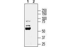 KCNK16 antibody  (1st Extracellular Loop)