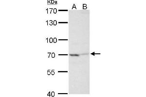 WB Image TNF alpha IP2 antibody detects TNF alpha IP2 protein by Western blot analysis. (TNIP2 antibody  (Center))