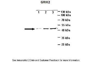 Lanes:   Lane1: 10ug mouse cortex brain lysate Lane2: 25ug mouse cortex brain lysate Lane3: 40ug mouse cortex brain lysate  Primary Antibody Dilution:   1:1000  Secondary Antibody:   Anti-rabbit HRP  Secondary Antibody Dilution:   1:2000  Gene Name:   GRIK2  Submitted by:   Anonymous (GRIK2 antibody  (N-Term))