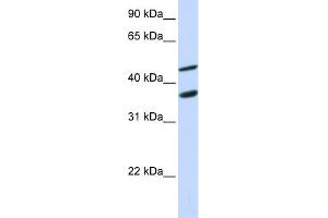 WB Suggested Anti-GAS7 Antibody Titration:  0. (GAS7 antibody  (N-Term))