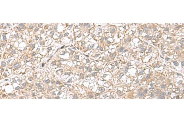 CPLX3 antibody