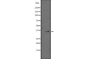 Western blot analysis of GZMK expression in Jurkat cell lysate,The lane on the left is treated with the antigen-specific peptide. (GZMK antibody  (Internal Region))