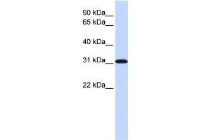 WB Suggested Anti-RPA4 Antibody Titration: 0. (RPA4 antibody  (Middle Region))