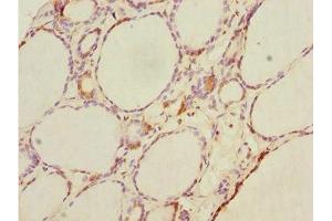 Immunohistochemistry of paraffin-embedded human thyroid tissue using ABIN7164417 at dilution of 1:100 (DTX2 antibody  (AA 1-280))