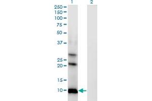 Western Blot analysis of AKR1CL1 expression in transfected 293T cell line by AKR1CL1 monoclonal antibody (M04), clone 4G8. (AKR1CL1 antibody  (AA 1-129))