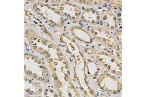 Immunohistochemistry of paraffin-embedded human kidney using PDGFRB antibody at dilution of 1:200 (x400 lens) (PDGFRB antibody)