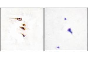 Immunohistochemistry analysis of paraffin-embedded human brain tissue, using EPHA6 Antibody. (EPH Receptor A6 antibody  (AA 891-940))