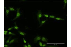 Immunofluorescence (IF) image for anti-Phosphatidylinositol 4-Kinase Type 2 alpha (PI4K2A) (AA 1-479) antibody (ABIN949448)