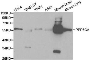 Western blot analysis of extracts of various cell lines, using PPP3CA antibody.