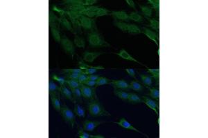 Immunofluorescence analysis of C6 cells using D Polyclonal Antibody (ABIN7266712) at dilution of 1:100 (40x lens).