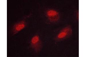 ABIN6267669 staining HeLa cells by ICC/IF. (CAMK4 antibody  (pThr200))
