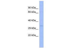 WB Suggested Anti-ZNF80 Antibody Titration:  0.