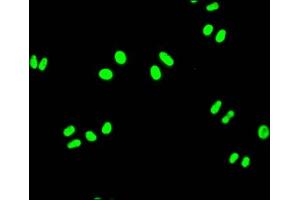 Immunofluorescence staining of Hela Cells with ABIN7127503 at 1:50, counter-stained with DAPI. (Recombinant FUBP1 antibody)