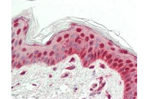 Human Skin: Formalin-Fixed, Paraffin-Embedded (FFPE) (CPSF3 antibody  (AA 1-50))