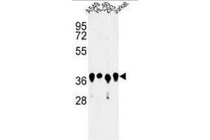 Western blot analysis of ARGLU1 Antibody (N-term) in A549, HL-60, 293, Jurkat cell line lysates (35µg/lane). (ARGLU1 antibody  (N-Term))