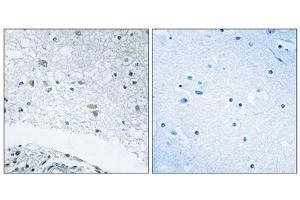 Immunohistochemistry analysis of paraffin-embedded human brain tissue using LAMC3 antibody. (LAMC3 antibody  (C-Term))
