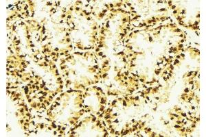 ABIN6277069 at 1/100 staining Human lung tissue by IHC-P. (HDAC2 antibody  (Internal Region))