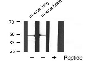 Western blot analysis of Phospho-HDAC3 (Ser424) Antibody expression in mouse lung and mouse brain tissues lysates. (HDAC3 antibody  (pSer424))