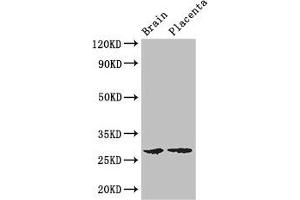 Western Blot Positive WB detected in: Mouse brain tissue, Human placenta tissue All lanes: FBXL22 antibody at 3 μg/mL Secondary Goat polyclonal to rabbit IgG at 1/50000 dilution Predicted band size: 28 kDa Observed band size: 28 kDa (FBXL22 antibody  (AA 123-229))