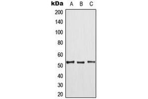 Western blot analysis of TPL2 (pT290) expression in HepG2 (A), mouse liver (B), rat liver (C) whole cell lysates.