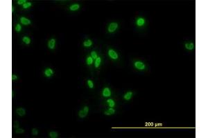 Image no. 3 for anti-TATA Box Binding Protein Associated Factor 11 (TAF11) (AA 158-211) antibody (ABIN598958) (TAF11 antibody  (AA 158-211))