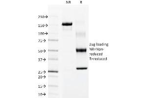 SDS-PAGE Analysis Purified Cytokeratin 15 Mouse Monoclonal Antibody (LHK15). (KRT15 antibody  (C-Term))