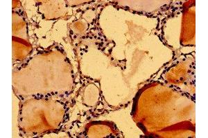 Immunohistochemistry (IHC) image for anti-Nuclear Mitotic Apparatus Protein 1 (NUMA1) (AA 627-870) antibody (ABIN7161807)