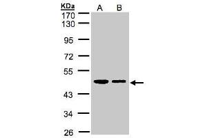 WB Image Sample(30 ug whole cell lysate) A:A431, B:H1299 10% SDS PAGE antibody diluted at 1:1000 (ERP44 antibody)