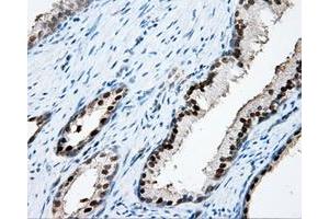 Immunohistochemical staining of paraffin-embedded Kidney tissue using anti-APP mouse monoclonal antibody. (APP antibody)