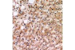 Immunohistochemical analysis of IL-19 staining in human liver formalin fixed paraffin embedded tissue section. (IL-19 antibody)