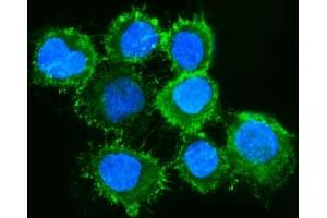 IF analysis of Moesin/MSN using anti-Moesin/MSN antibody (ABIN7600379).