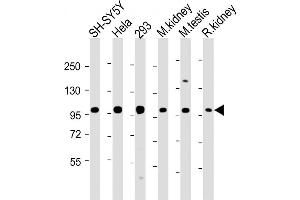 PGAP1 antibody  (AA 90-122)