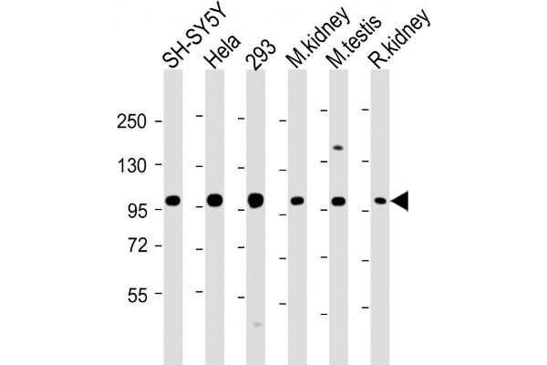 PGAP1 antibody  (AA 90-122)