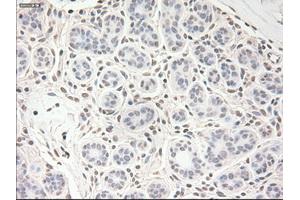 Immunohistochemical staining of paraffin-embedded breast tissue using anti-VEGF mouse monoclonal antibody. (VEGF antibody  (AA 27-233))