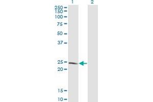 Western Blot analysis of LYPLA1 expression in transfected 293T cell line by LYPLA1 monoclonal antibody (M05), clone 3D5. (LYPLA1 antibody  (AA 66-151))