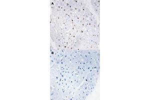 Immunohistochemical staining (Formalin-fixed paraffin-embedded sections) of human heart tissue with BLM (phospho T99) polyclonal antibody  without blocking peptide (A) or preincubated with blocking peptide (B) under 1:50-1:100 dilution. (BLM antibody  (pThr99))