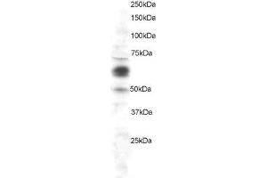 ABIN2561965 staining (1µg/ml) of HeLa lysate (RIPA buffer, 30µg total protein per lane).