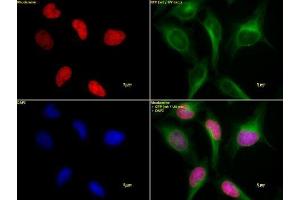 Histone H3K4ac antibody (pAb) tested by immunofluorescence.