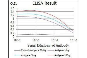 Black line: Control Antigen (100 ng), Purple line: Antigen(10 ng), Blue line: Antigen (50 ng), Red line: Antigen (100 ng), (Moesin antibody)