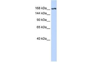 WB Suggested Anti-KDR Antibody Titration:  0. (VEGFR2/CD309 antibody  (N-Term))