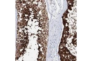 Immunohistochemical staining of human testis with C10orf53 polyclonal antibody  shows strong cytoplasmic positivity in cells in seminiferus ducts.