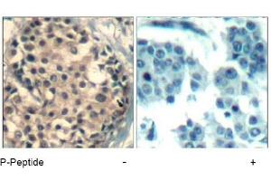 Image no. 2 for anti-HDAC4,HDAC5,HDAC9 (pSer220), (pSer246), (pSer259) antibody (ABIN319280) (HDAC4/HDAC5/HDAC9 antibody  (pSer220, pSer246, pSer259))