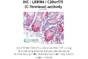 Image no. 1 for anti-Leucine Rich Repeat Neuronal 4 (LRRN4) (C-Term) antibody (ABIN1736586) (LRRN4 antibody  (C-Term))