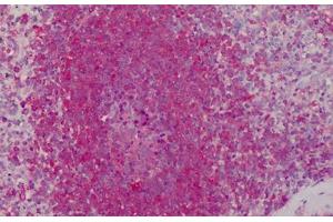 Human Spleen: Formalin-Fixed, Paraffin-Embedded (FFPE) (Peroxiredoxin 1 antibody  (AA 1-184))